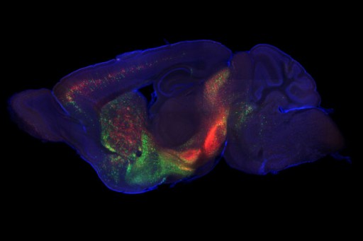 dopamine_neurons