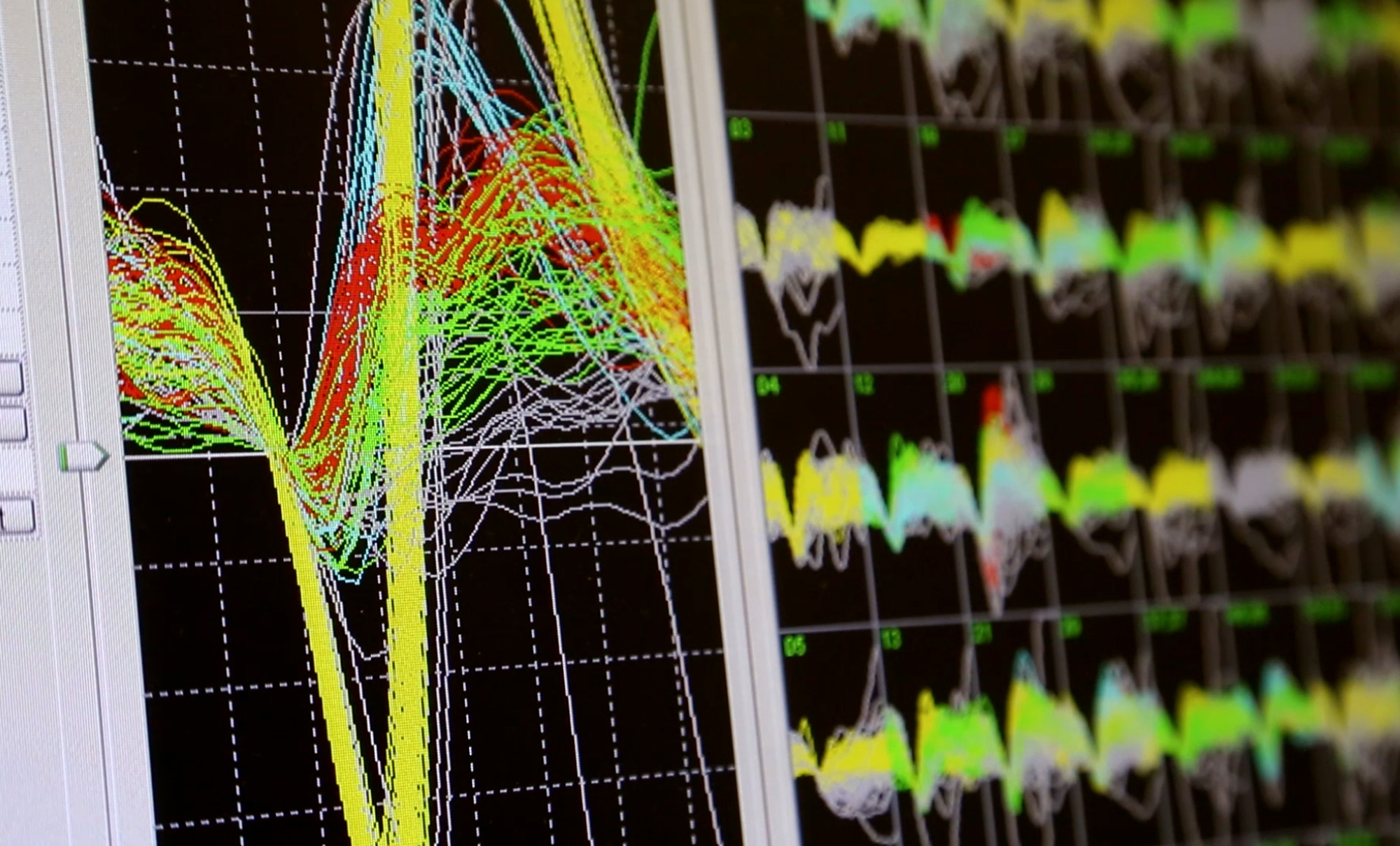 duke-nicolelis-primate-brain-machine-interface