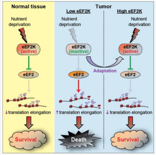 eEF2 Kinase
