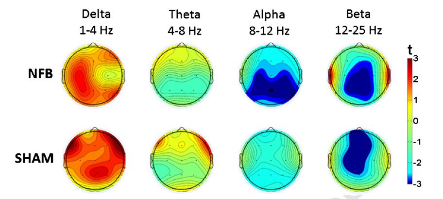 eeg_amplitide_change_during_feedback eeg_amplitide_change_during_feedback