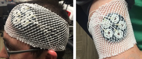 electrode placement