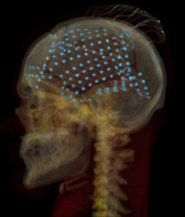 electrodes350