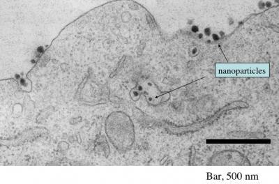 Electron micrograph