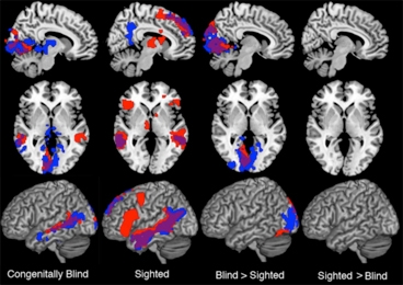 fMRI brain scans during language processing tasks