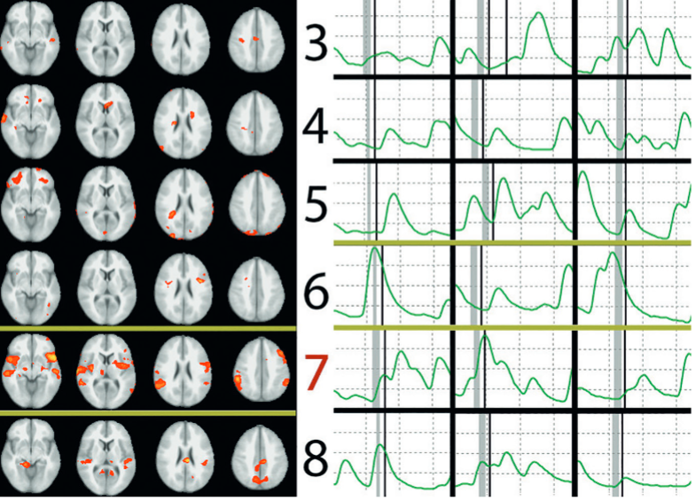 fmri vs. polygraph