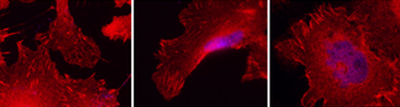 focal adhesions