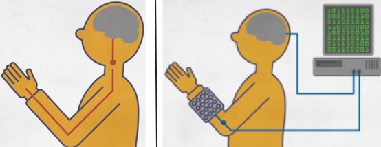 how neural bypass system works