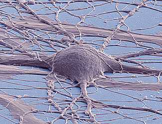 huma-ipsc-derived-neuron-deerinck