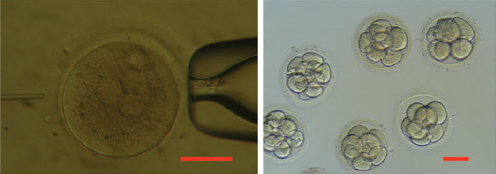 human 3PN zygote