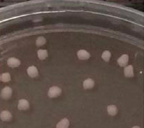human cortical steroids in dish
