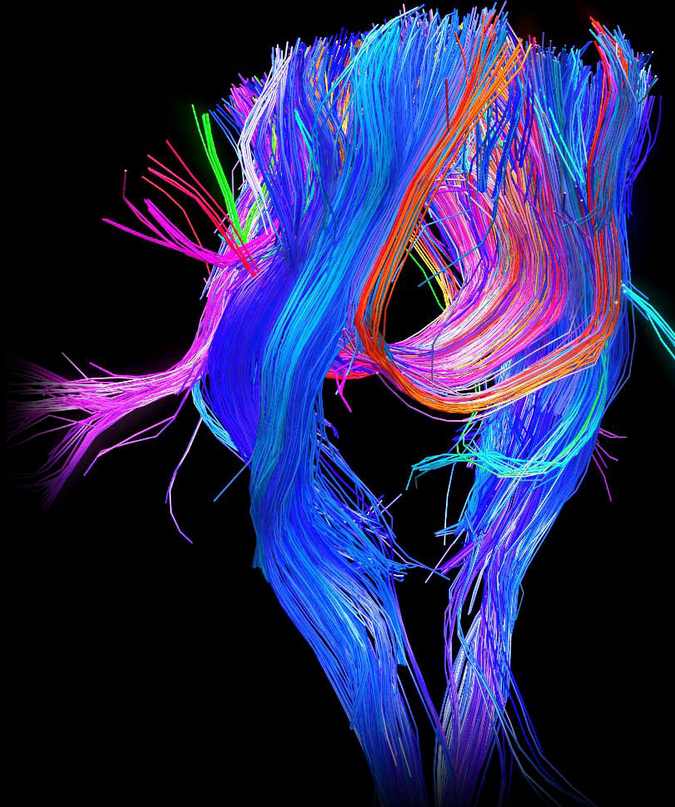 human_connectome_project