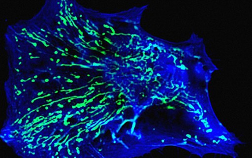Primary human fibroblast cell