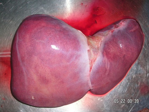 human_liver