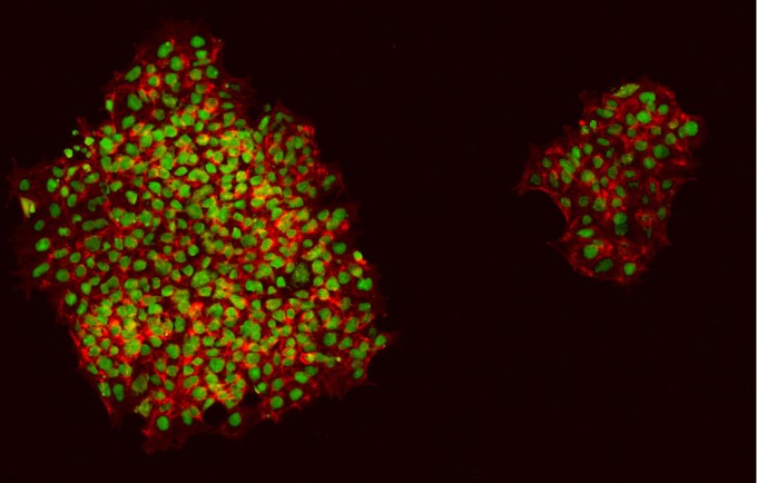 iPSC-derived keratinocytes colonies