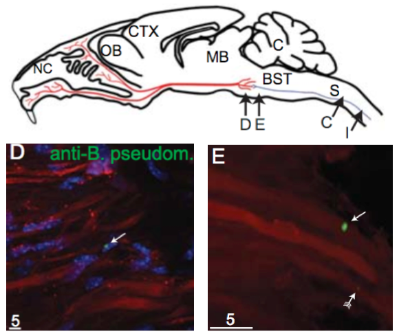 infected_mouse_brain