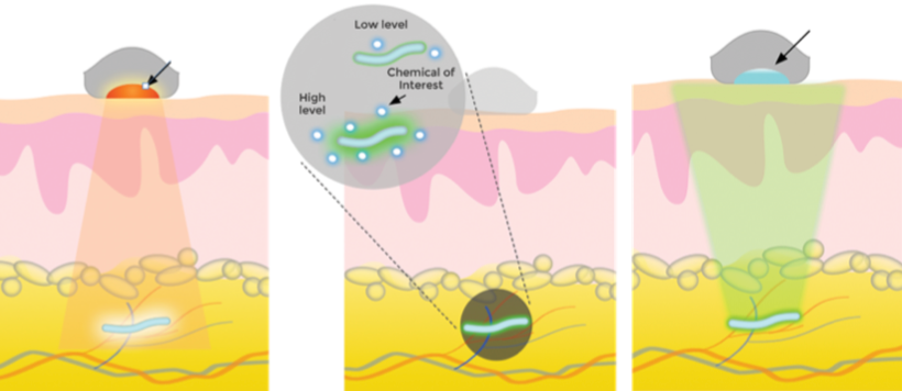 injectable body sensors