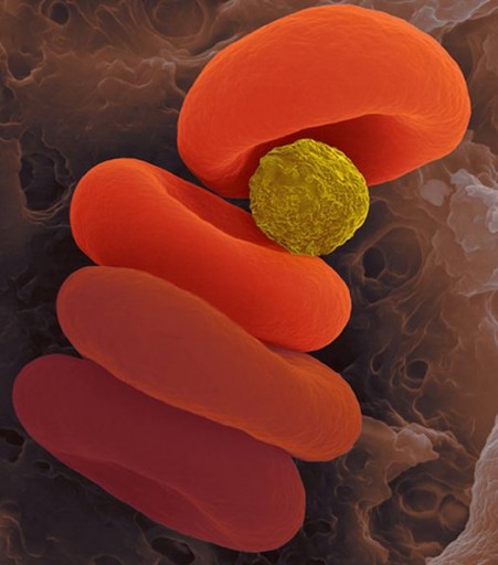injected_microparticle