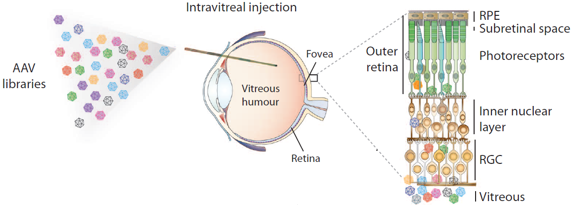 intravitreal_injection