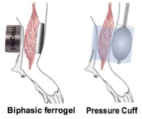 mechanotherapies
