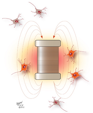 mgh_magnetic_stimulation_neurons