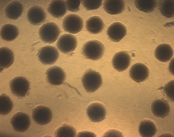 microgels_high-glucose_s_animated microgels_high-glucose_s_animated