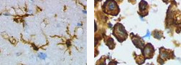 microglia before - after