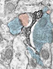 microglia