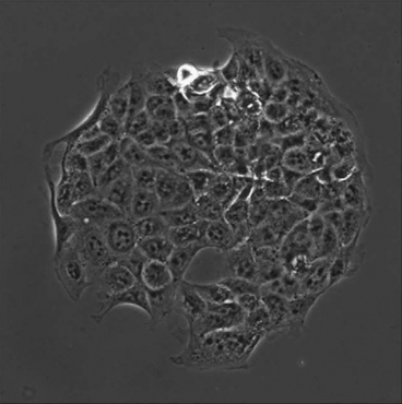 mit-cancer-cells
