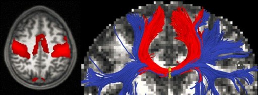 mit_mapping_neurological_disease