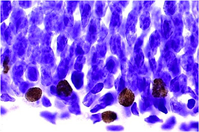 more-new-neurons-in-runners_400