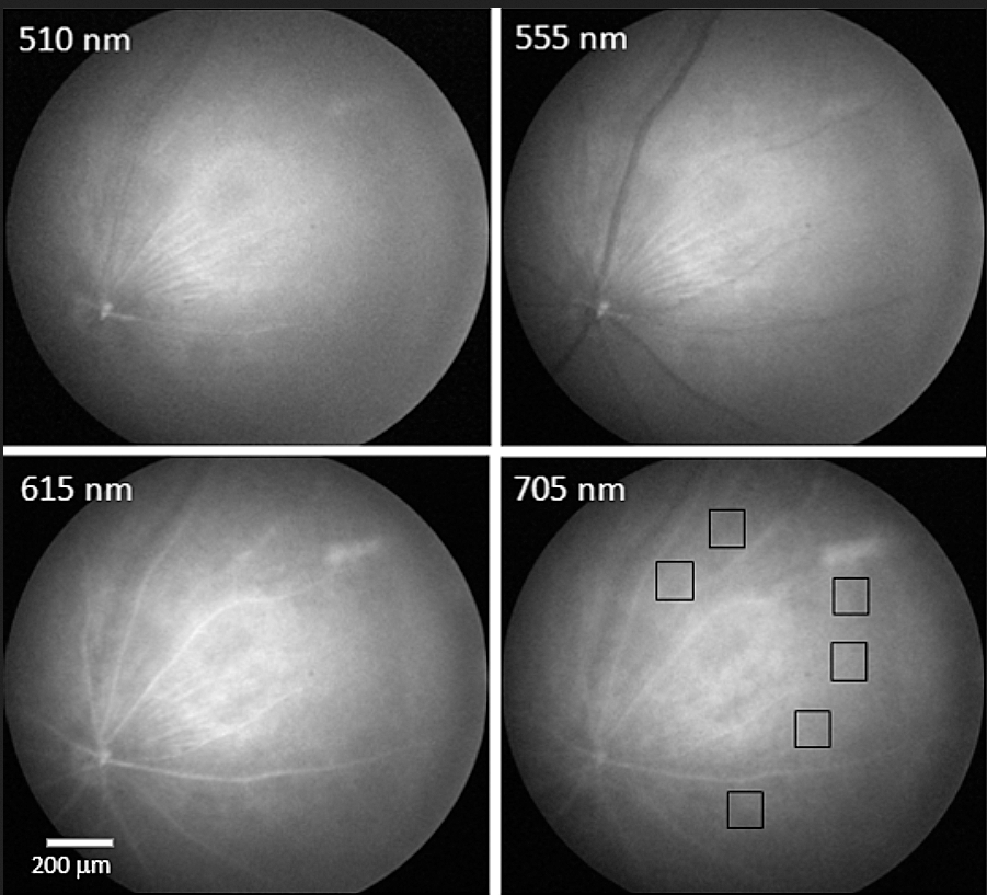 mouse retina