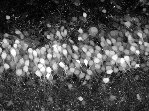 mouse_hippocampus mouse_hippocampus