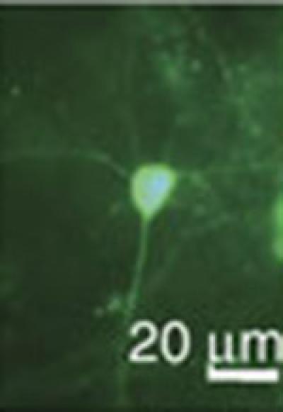 mouse_neuron_expressing_GCaMP3