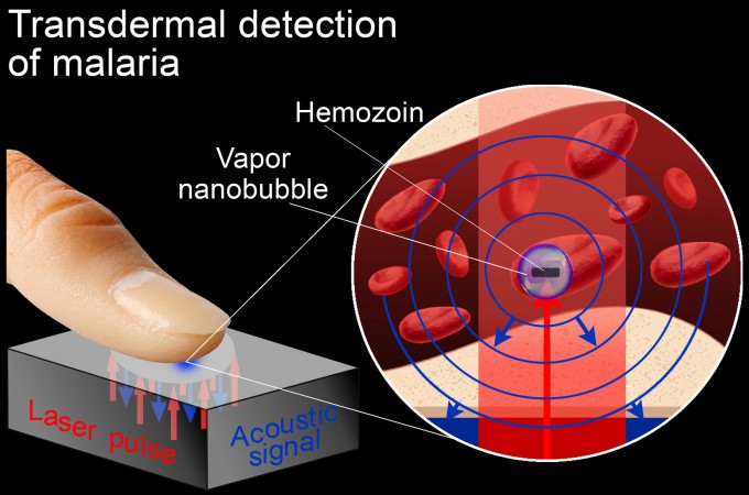 nanobubble_malaria