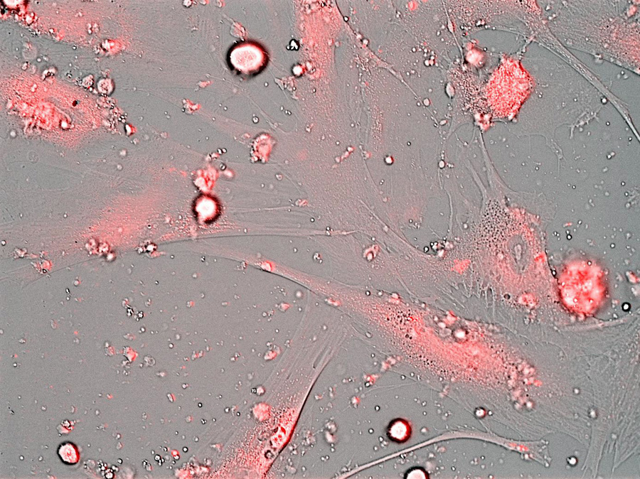 nanoparticles_ruvid nanoparticles_ruvid