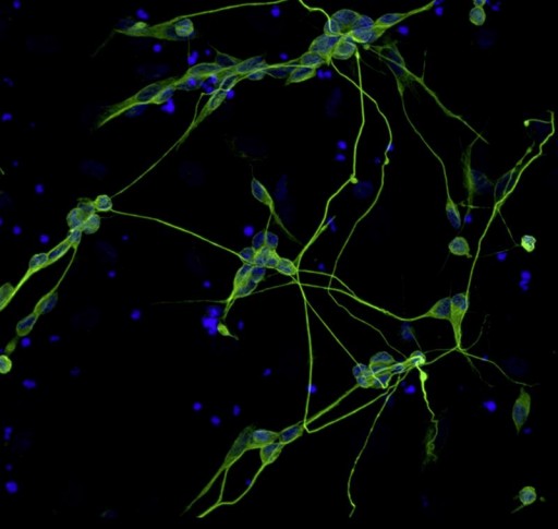 nerve_cells_from_skin_cells
