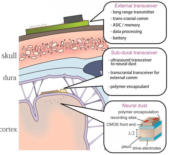 neural dust -- UCB