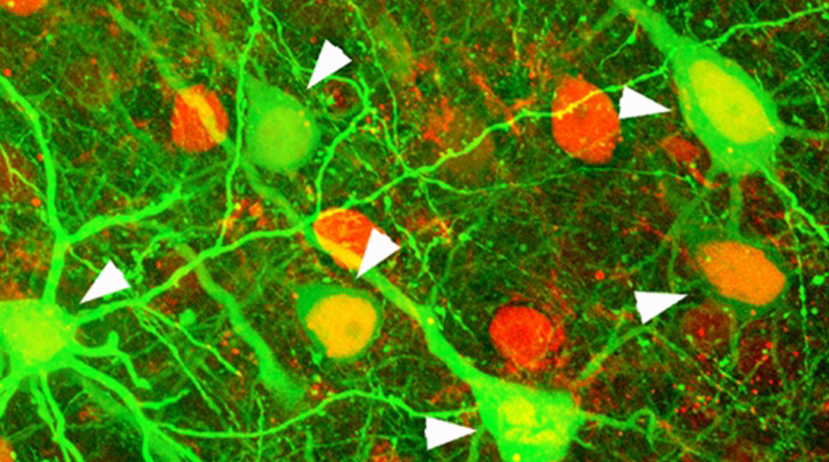 neural network - CMU