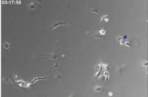 neuronal_reeprogramming