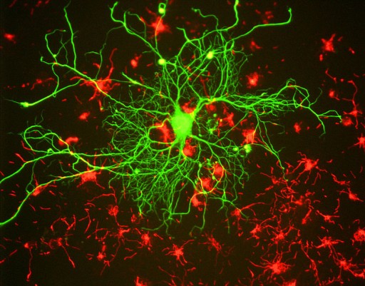 neuronalstemcells