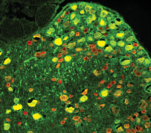 neurons_repaired_by_gene_therapy