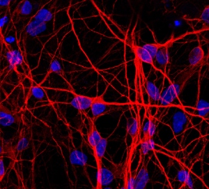 neurons_from_urine