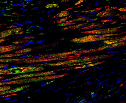 newly_formed_mycocytes