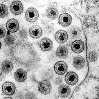 oncolytic_virus