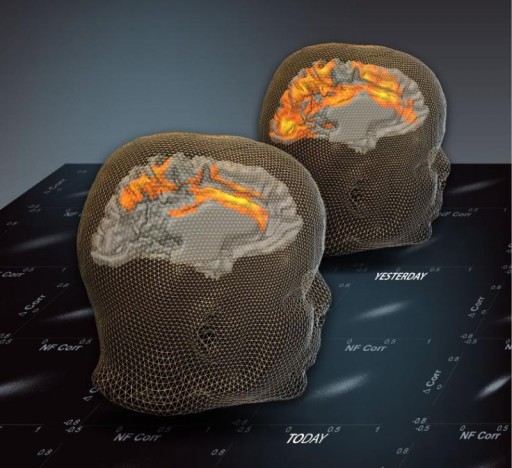 past_brain_activation
