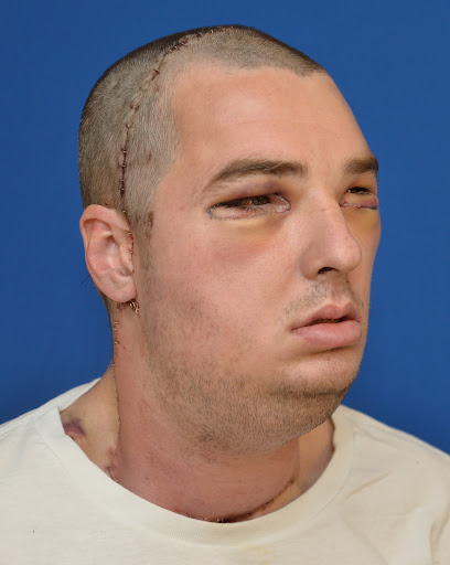 patient-after-surgery
