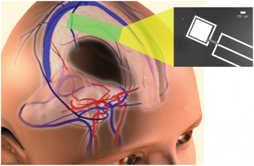 power_extraction_from_cerebrospinal_fluid