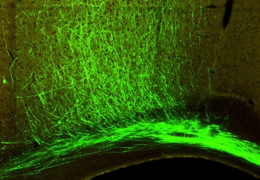 primary somatosensory cortex