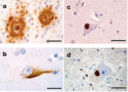 prion_like_protein_aggregates prion_like_protein_aggregates