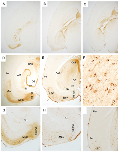 progresivespreadoftauopathy